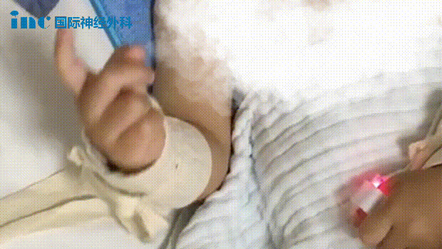 北京天壇醫院手術紀實 - 母子連心戰勝腦干膠質瘤，全家人的